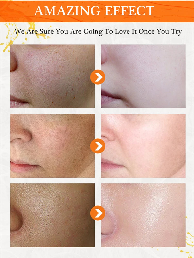 Crème éclaircissante pour le visage à la vitamine C, hydratante, émolliente, élimination des taches foncées, raffermissante, Anti-vieillissement, réparation, soins pour la peau
