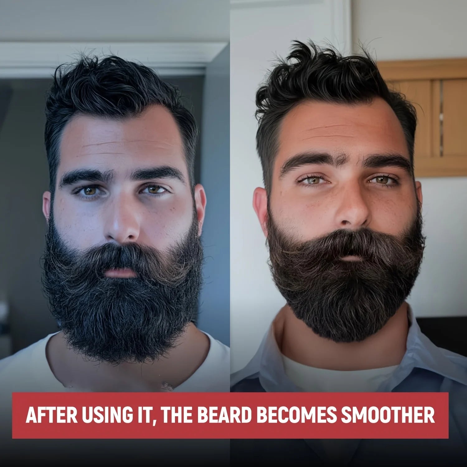 Huile essentielle de barbe riche en huile de ricin, croissance de la barbe et toilettage adoucir nourrir soin de la barbe rouleau longueur d'aiguille inférieure à 0,25 mm