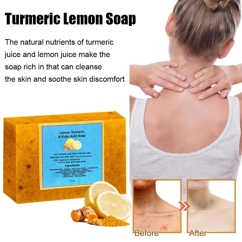 Savon biologique à l'acide kojique au citron et au curcuma pour les taches foncées, savon au curcuma pour le lavage du visage, éclaircissant, correcteur de taches foncées, soins pour la peau