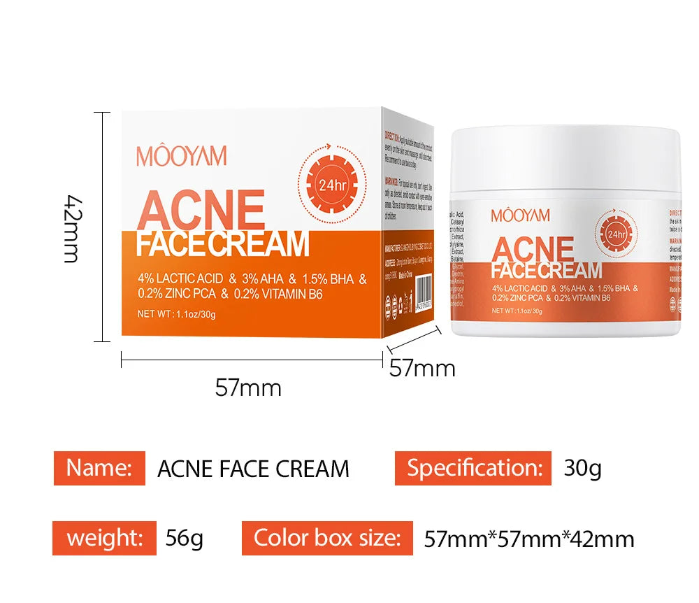 Crème de traitement anti-acné pour le visage, élimine les boutons, les taches, contrôle du sébum, resserre les pores, hydratante, soin de la peau