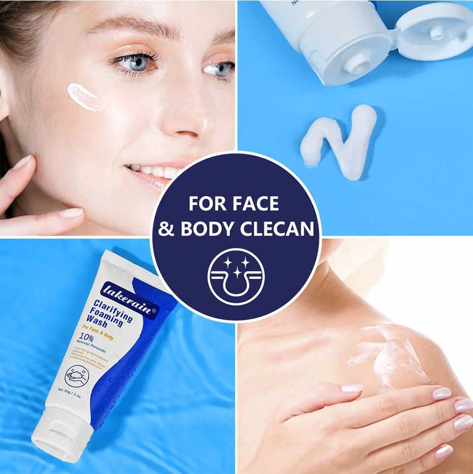 Lavage moussant contre l'acné, nettoyage en profondeur, débouche les Pores, prévient les défauts pour les hydratants du visage et du corps, réduit les rougeurs, soins pour la peau