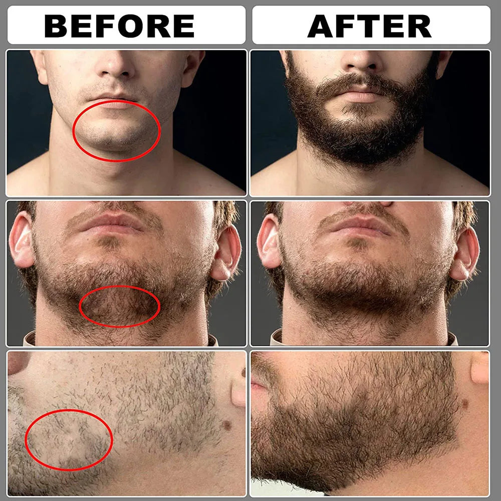 Ensemble complet de soins de barbe pour hommes, peigne à barbe, baume, peigne Double face avec rouleau, liquide de croissance de barbe, 5/7/8 pièces