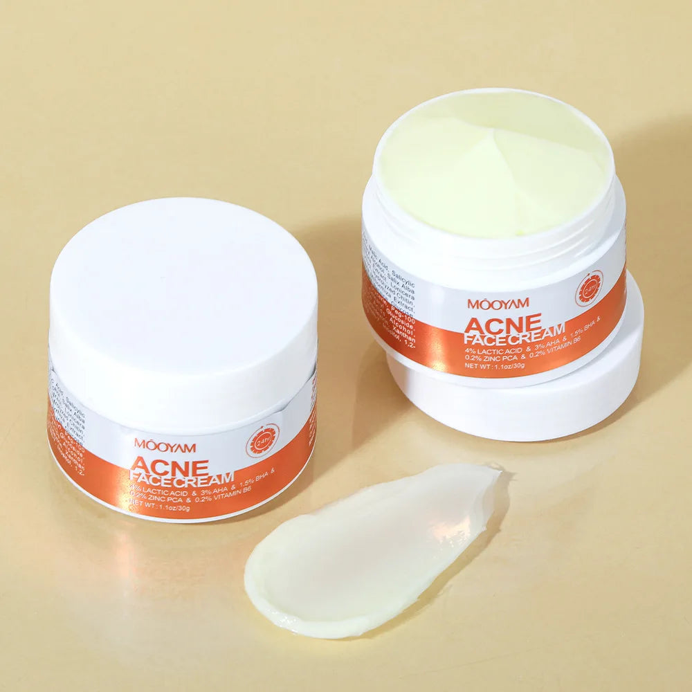 Crème de traitement anti-acné pour le visage, élimine les boutons, les taches, contrôle du sébum, resserre les pores, hydratante, soin de la peau