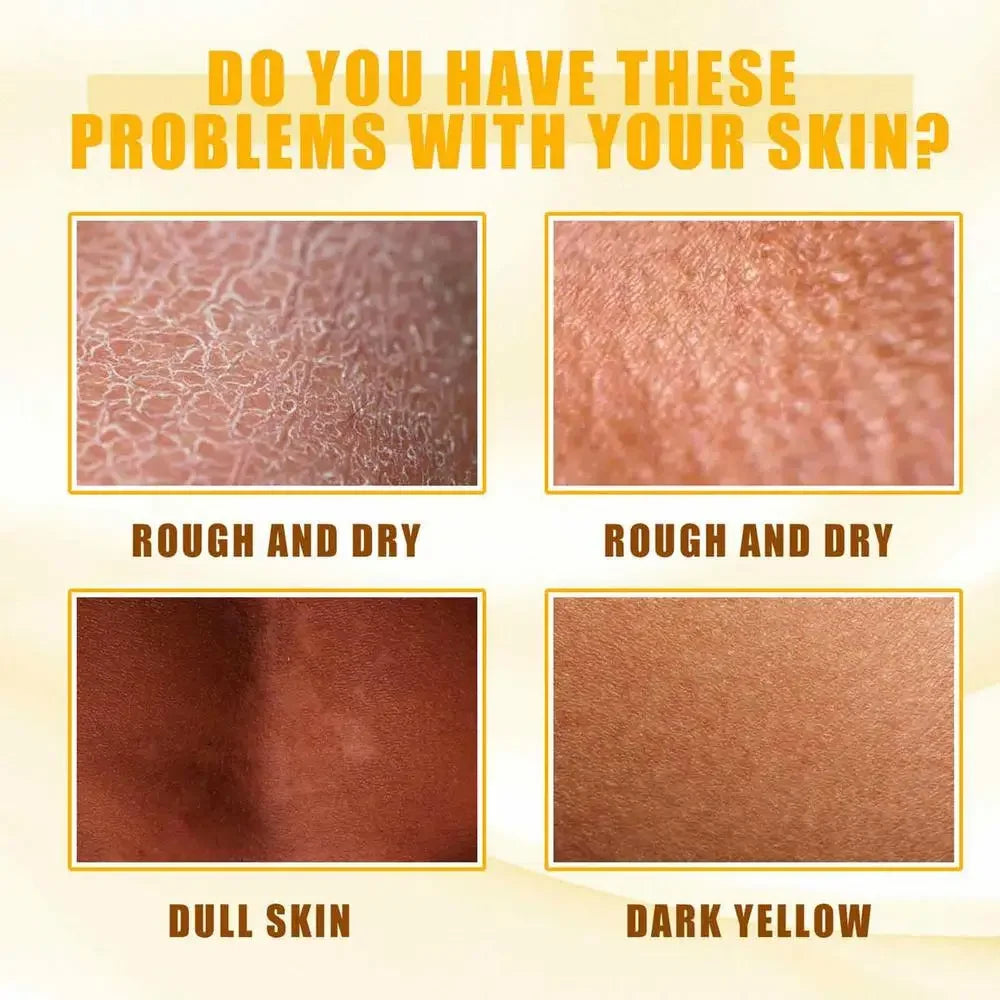 Sérum blanchissant jaune Wiltshire Peeling, huile de soin de la peau à fréquence exponsive, peau foncée, enlever les bras, les genoux, les jambes, mélanine, gIslande éclaircissant pour le corps