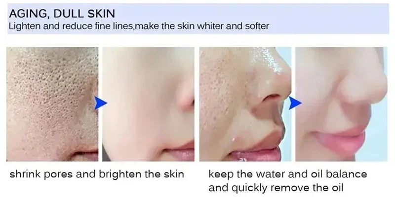 Crème rétrécissante pour les pores à l'acide salicylique, élimine les grands Pores, sérum, élimine les points noirs, répare l'acné, raffermissement, soins pour la peau, cosmétiques