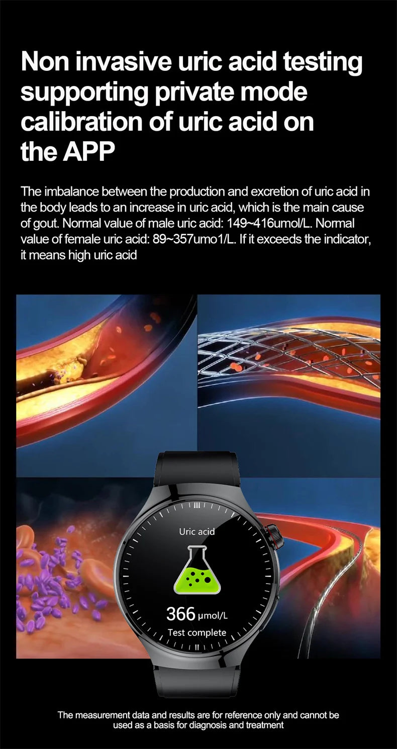 Nouvelle surveillance de la santé montre intelligente examen physique santé Wacth pression artérielle ECG + PPG Sport appel Smartwatch pour Android iOS