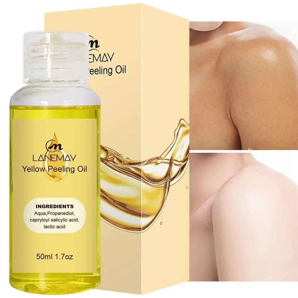 Sérum blanchissant jaune Wiltshire Peeling, huile de soin de la peau à fréquence exponsive, peau foncée, enlever les bras, les genoux, les jambes, mélanine, gIslande éclaircissant pour le corps