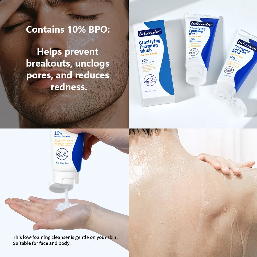 Lavage moussant contre l'acné, nettoyage en profondeur, débouche les Pores, prévient les défauts pour les hydratants du visage et du corps, réduit les rougeurs, soins pour la peau