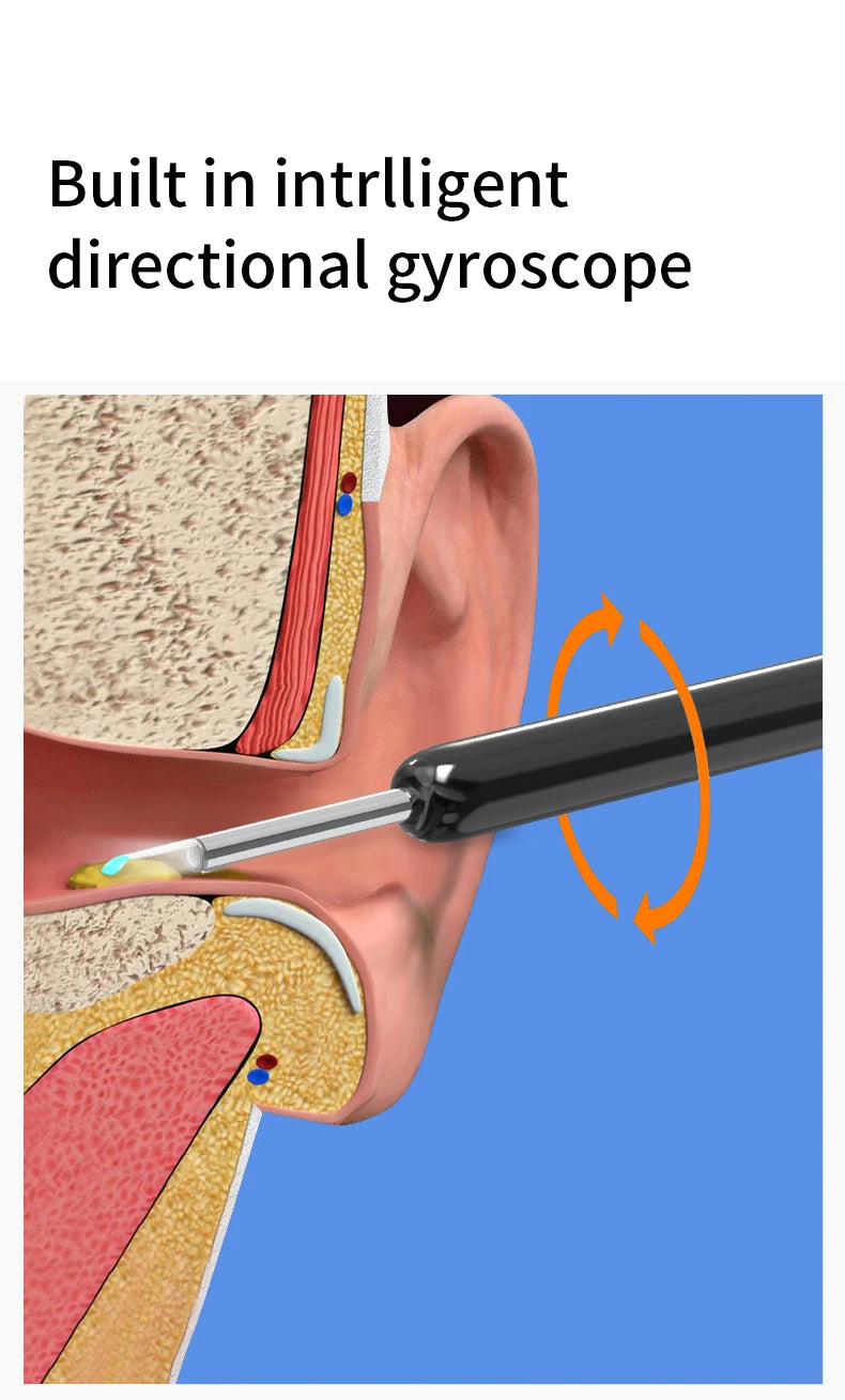 NE3 nettoyeur d'oreilles outil de retrait de cire d'oreille de haute précision avec caméra LED Otoscope sans fil Kit de nettoyage d'oreille intelligent meilleur cadeau