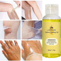 Sérum blanchissant jaune Wiltshire Peeling, huile de soin de la peau à fréquence exponsive, peau foncée, enlever les bras, les genoux, les jambes, mélanine, gIslande éclaircissant pour le corps