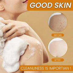 Savon biologique à l'acide kojique au citron et au curcuma pour les taches foncées, savon au curcuma pour le lavage du visage, éclaircissant, correcteur de taches foncées, soins pour la peau