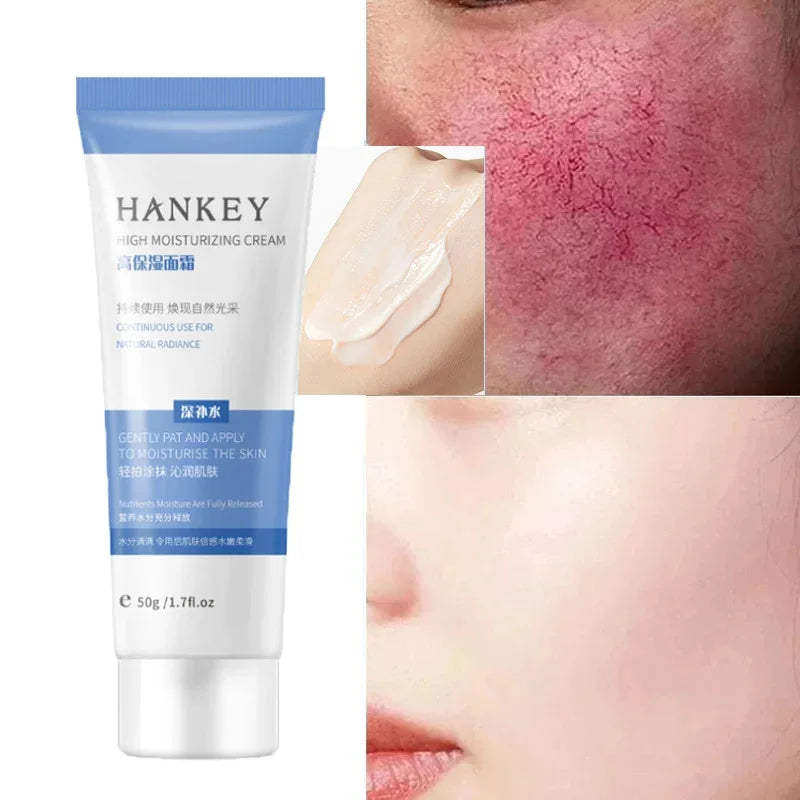 Crème réparatrice pour les rougeurs du visage, améliore la sécheresse de la peau sensible, hydratante, Lotion apaisante, élimination de la Rosacea, cosmétiques coréens