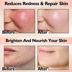 Crème réparatrice pour les rougeurs du visage, améliore la sécheresse de la peau sensible, hydratante, Lotion apaisante, élimination de la Rosacea, cosmétiques coréens