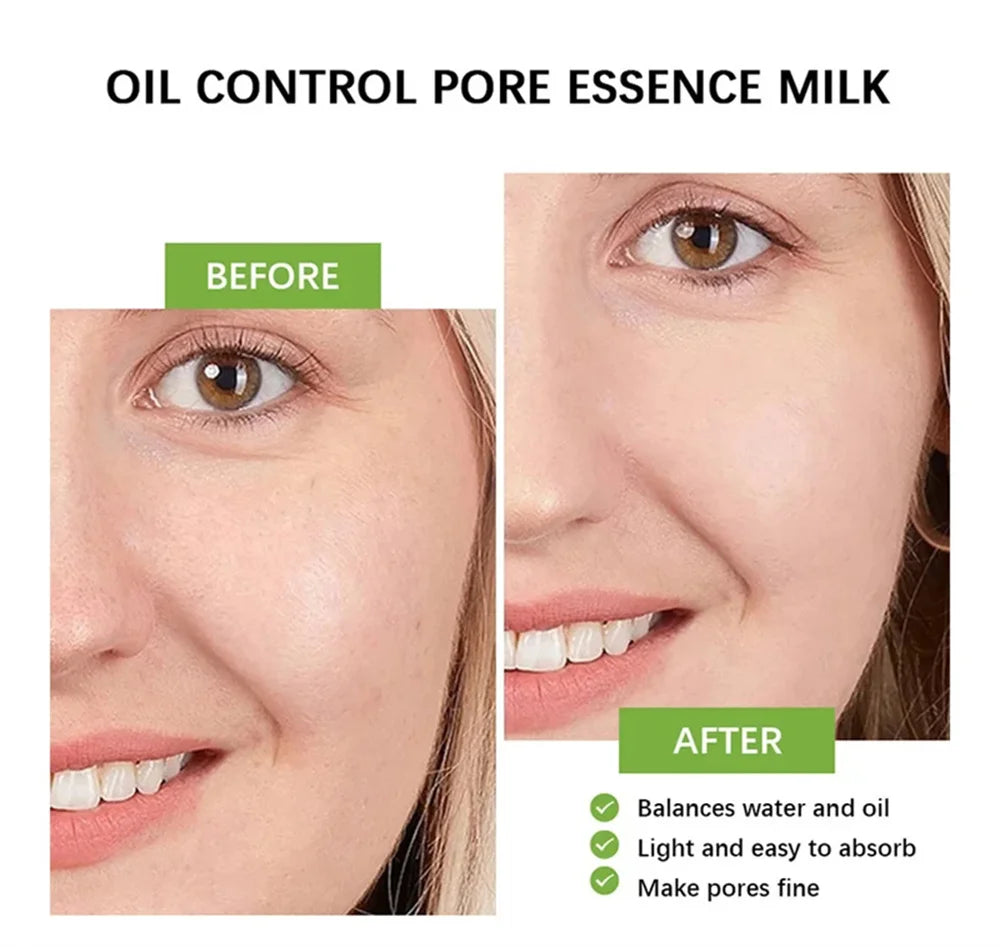 Sérum rétrécissement des pores à l'acide salicylique, élimination rapide des grands Pores, élimine les points noirs, l'acné, resserre la peau lisse, produit de soins coréen