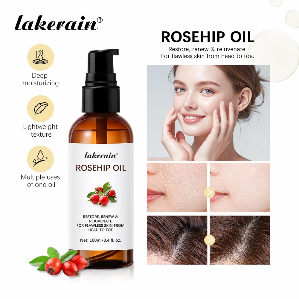 Huile de rose musquée biologique, huiles pour le visage, 30ml, soins pour la peau à absorption rapide, hydratant, huile pour le visage, Essence de graines de rose musquée biologique