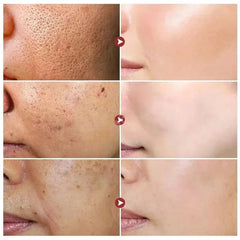 Sérum rétrécissement des pores à l'acide salicylique, élimination rapide des grands Pores, élimine les points noirs, l'acné, resserre la peau lisse, produit de soins coréen