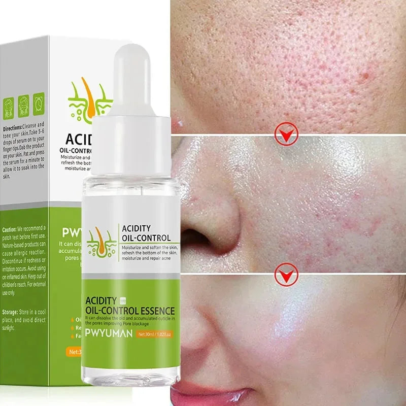 Crème rétrécissante pour les pores à l'acide salicylique, élimine les grands Pores, sérum, élimine les points noirs, répare l'acné, raffermissement, soins pour la peau, cosmétiques