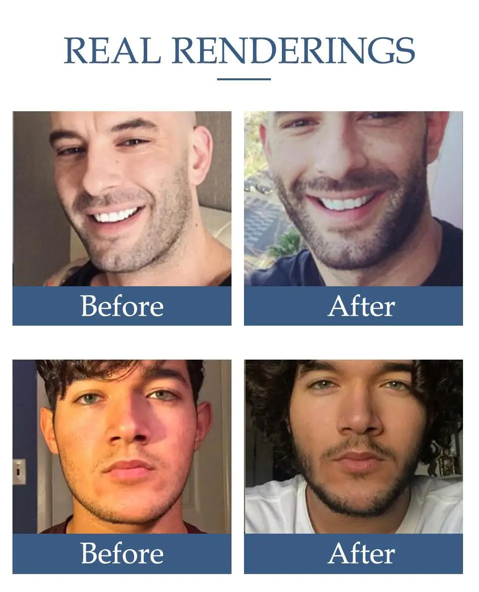 Huile naturelle pour la croissance de la barbe pour hommes, hydratante, lissante, outils de croissance des cheveux, revitalisant pour messieurs, soins pour la barbe