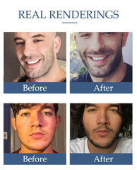 Huile naturelle pour la croissance de la barbe pour hommes, hydratante, lissante, outils de croissance des cheveux, revitalisant pour messieurs, soins pour la barbe