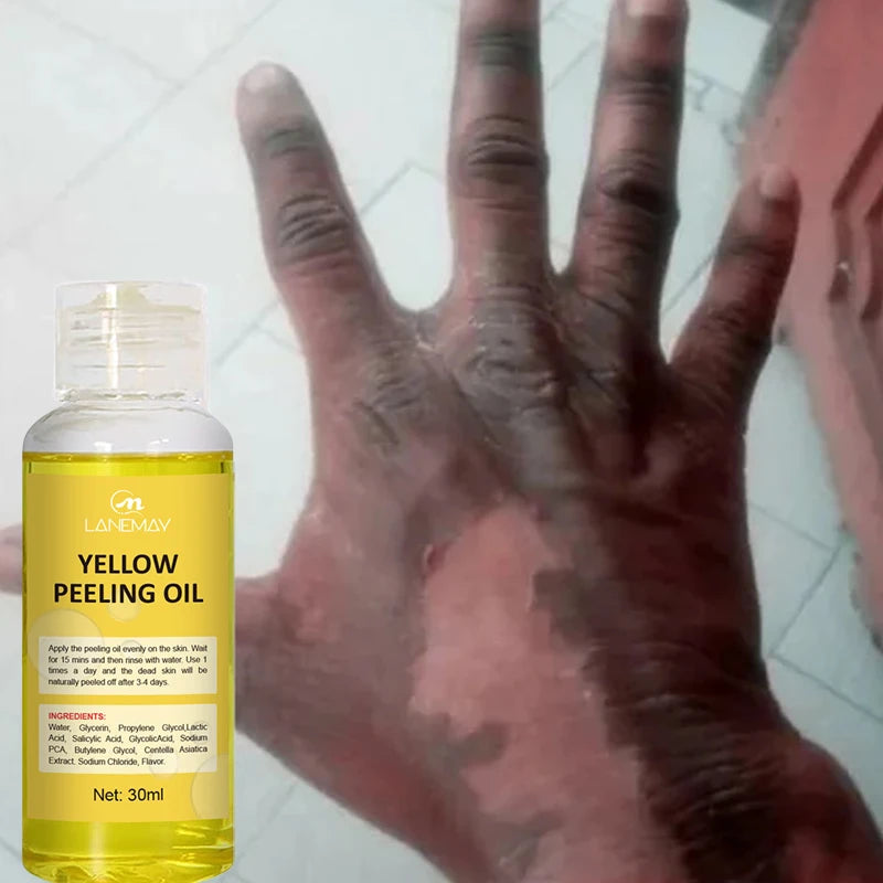 Huile de Peeling Jaune pour le Bain, Accessoire pour Blanchir la Peau Foncée, Éclaircir le Corps, les Coudes, les Genoux, la Main, Fréquence Exexponsive, Nourrir la Peau