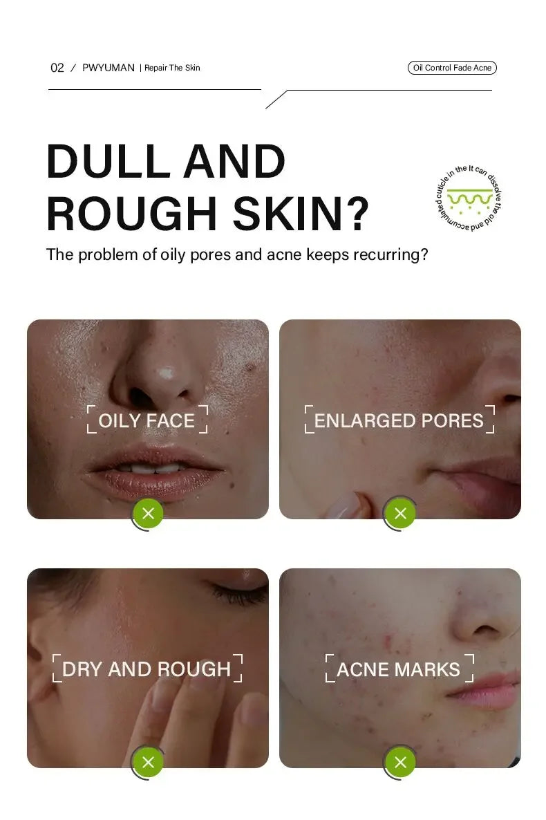 Sérum pour le visage anti-acidité, rétrécissement des pores, élimination des points noirs, contrôle de l'acné, réparation de l'huile, essence hydratante, nourrit les pores, raffermissant, soin du visage