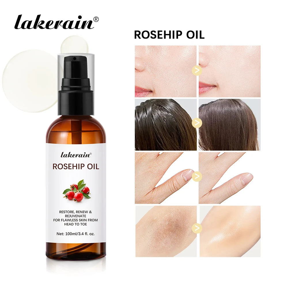 Huile de rose musquée biologique, huiles pour le visage, 30ml, soins pour la peau à absorption rapide, hydratant, huile pour le visage, Essence de graines de rose musquée biologique