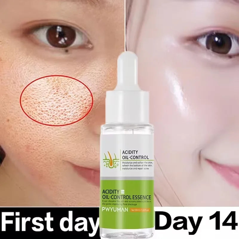 Sérum pour le visage anti-acidité, rétrécissement des pores, élimination des points noirs, contrôle de l'acné, réparation de l'huile, essence hydratante, nourrit les pores, raffermissant, soin du visage