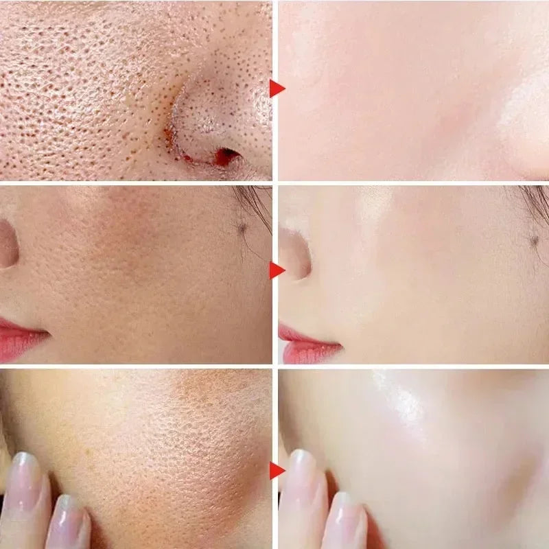 Crème rétrécissante pour les pores à l'acide salicylique, élimine les grands Pores, sérum, élimine les points noirs, répare l'acné, raffermissement, soins pour la peau, cosmétiques