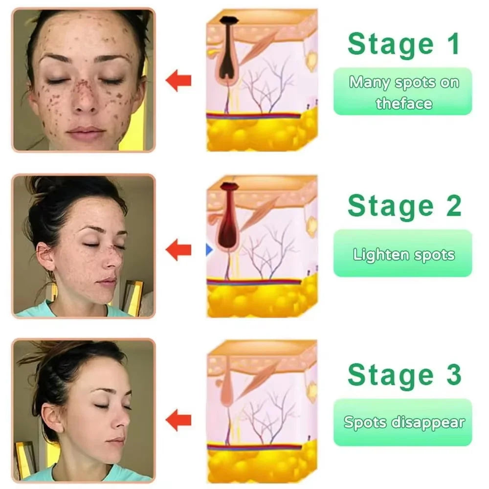 Revitalisez la peau acide de fruits Peeling Gel nettoyage du visage exfoliant Peeling gommage nettoyage en profondeur acné points noirs enlever visage nettoyant