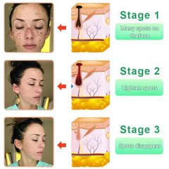 Revitalisez la peau acide de fruits Peeling Gel nettoyage du visage exfoliant Peeling gommage nettoyage en profondeur acné points noirs enlever visage nettoyant