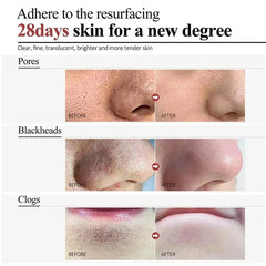 Sérum rétrécissement des pores à l'acide salicylique, élimination rapide des grands Pores, élimine les points noirs, l'acné, resserre la peau lisse, produit de soins coréen