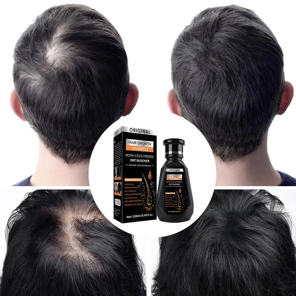 Shampoing au gingembre 250ml pour le nettoyage des cheveux, la stabilisation et les soins capillaires, répare la sécheresse des boucles et des dommages électrostatiques