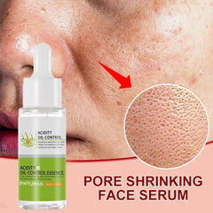 Sérum pour le visage anti-acidité, rétrécissement des pores, élimination des points noirs, contrôle de l'acné, réparation de l'huile, essence hydratante, nourrit les pores, raffermissant, soin du visage