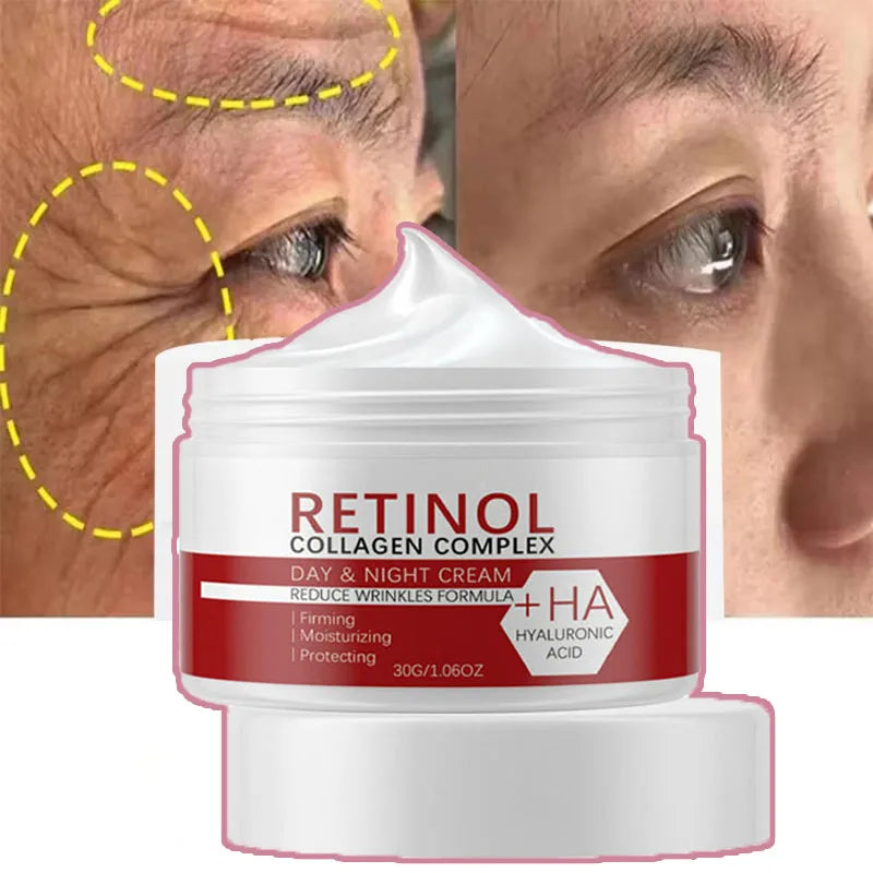 Crème blanchissante pour le visage et le corps, rétinol, collagène, acide hyaluronique 3 en 1, élimine les taches foncées, élimine la mélanine, dissipe l'acné, éclaircit la peau