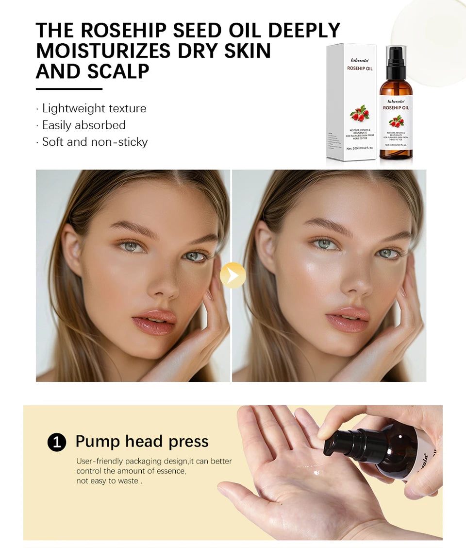 Huile de rose musquée biologique, huiles pour le visage, 30ml, soins pour la peau à absorption rapide, hydratant, huile pour le visage, Essence de graines de rose musquée biologique