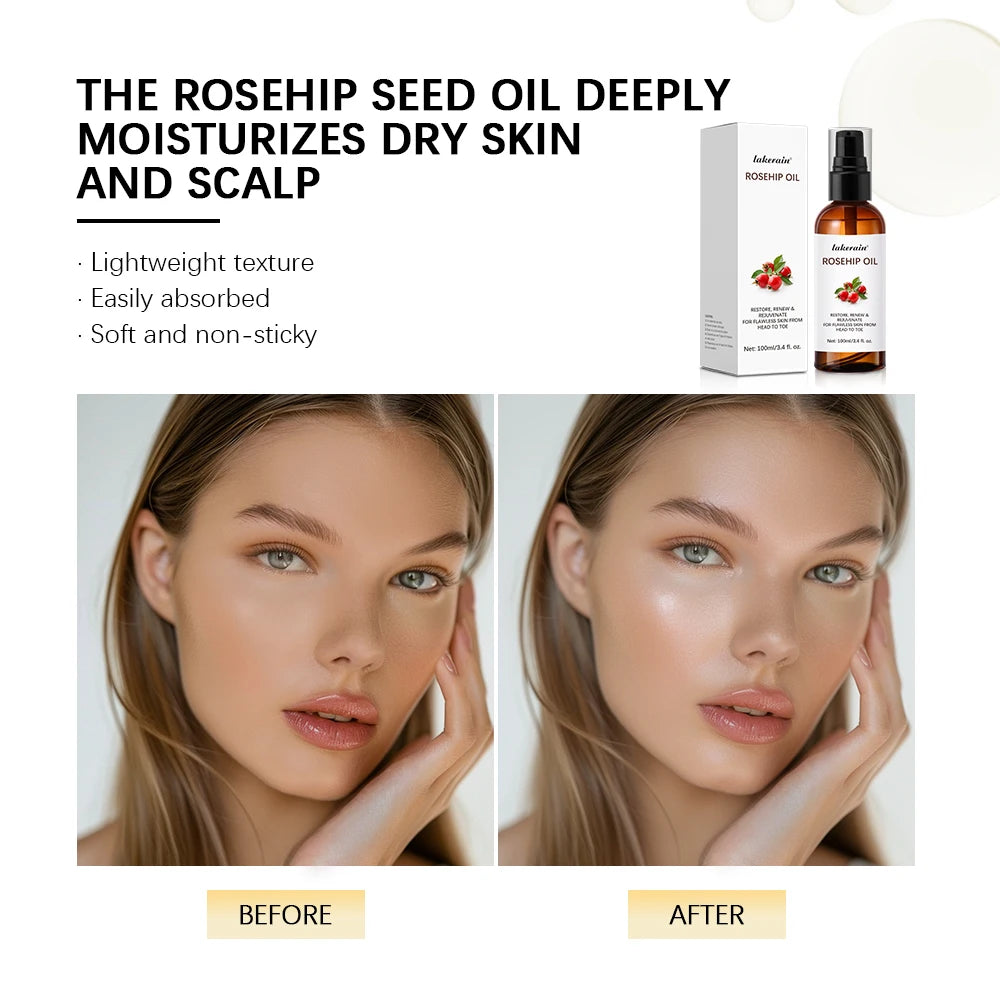 Huile de rose musquée biologique, huiles pour le visage, 30ml, soins pour la peau à absorption rapide, hydratant, huile pour le visage, Essence de graines de rose musquée biologique