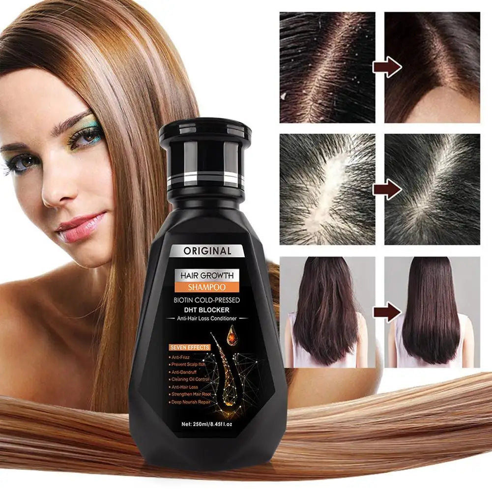Shampoing au gingembre 250ml pour le nettoyage des cheveux, la stabilisation et les soins capillaires, répare la sécheresse des boucles et des dommages électrostatiques
