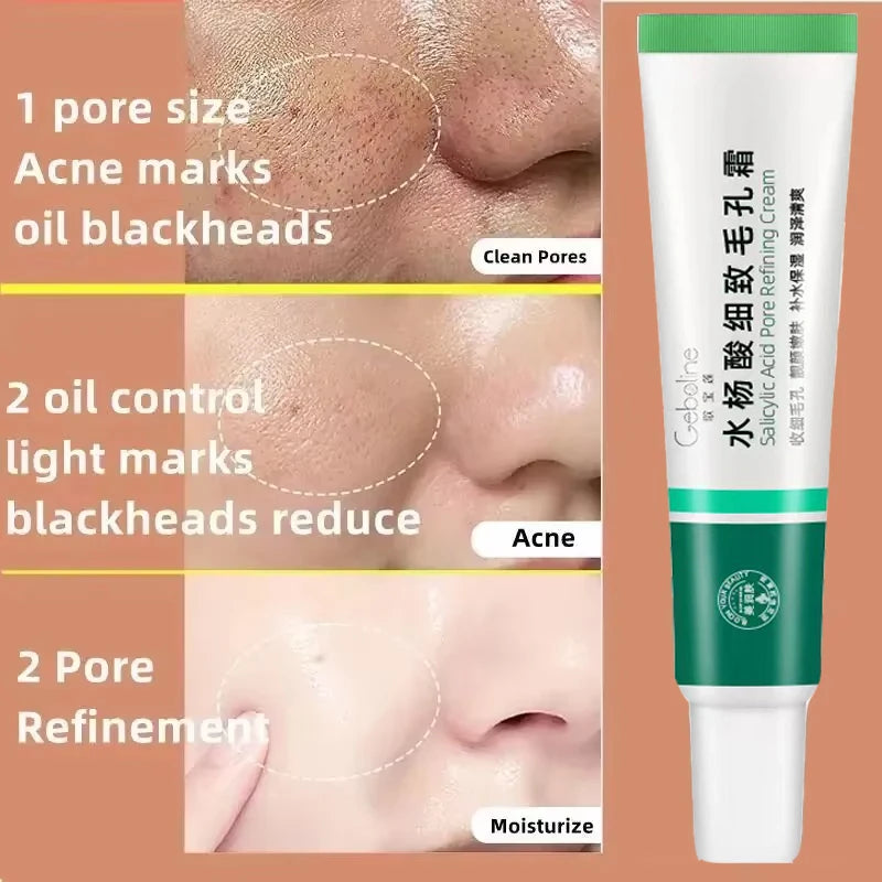Crème rétrécissante pour les pores à l'acide salicylique, élimine les grands Pores, sérum, élimine les points noirs, répare l'acné, raffermissement, soins pour la peau, cosmétiques