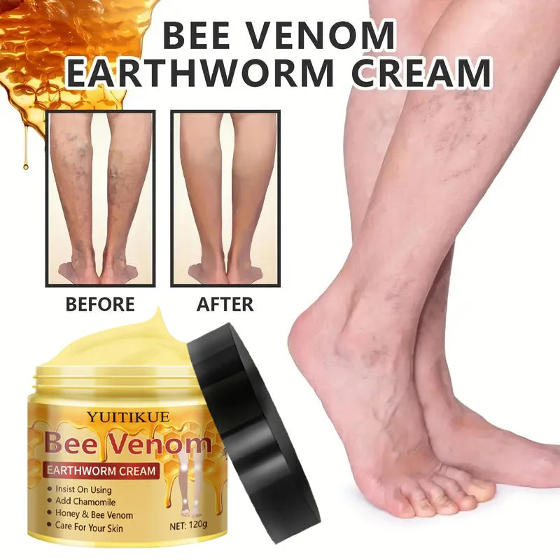 YUITIKUE Crème pour varices 120g - Formule de venin d'abeille et de vers de terre, hydratant et massage en profondeur, traitement de soins de la peau