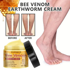 YUITIKUE Crème pour varices 120g - Formule de venin d'abeille et de vers de terre, hydratant et massage en profondeur, traitement de soins de la peau