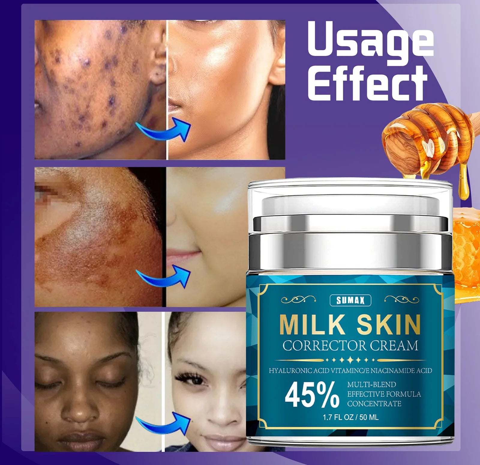 Sumax-Crème pour le visage au collagène de rétinol, soin hydratant à l'acide hyaluronique, raffermissant et éclaircissant à 5%, 50ml