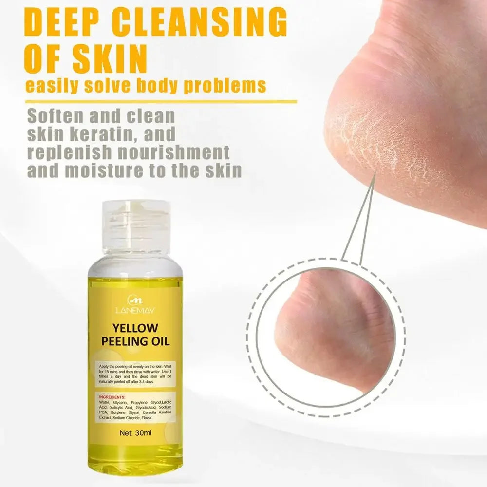 Sérum blanchissant jaune Wiltshire Peeling, huile de soin de la peau à fréquence exponsive, peau foncée, enlever les bras, les genoux, les jambes, mélanine, gIslande éclaircissant pour le corps