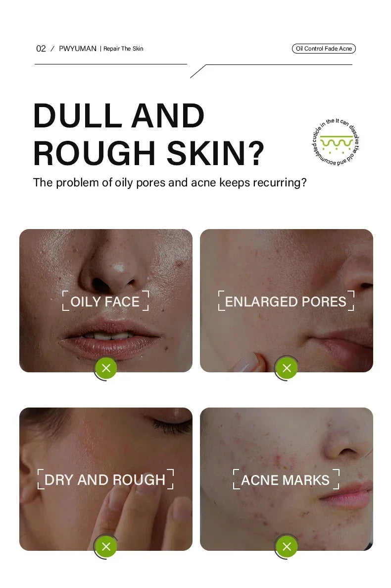 Crème rétrécissante pour les pores à l'acide salicylique, élimine les grands Pores, sérum, élimine les points noirs, répare l'acné, raffermissement, soins pour la peau, cosmétiques