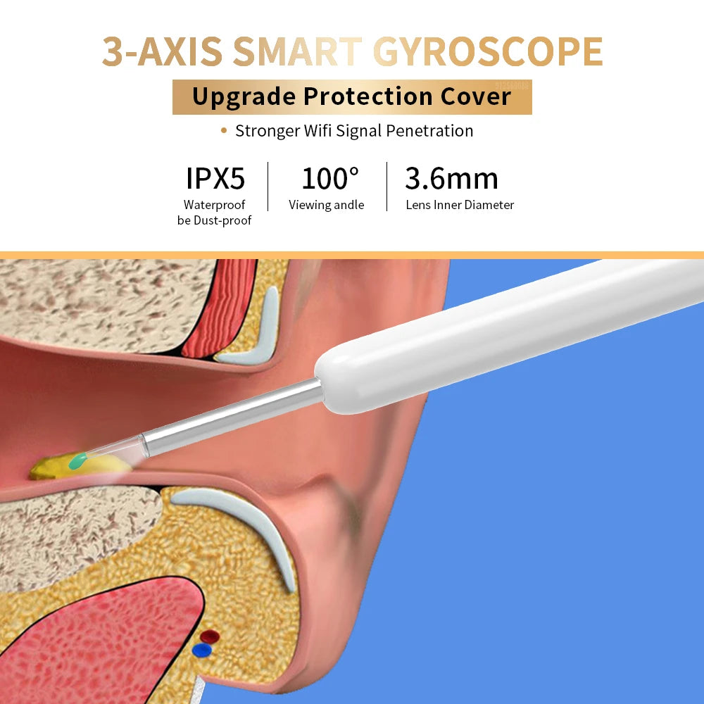 NE3 nettoyeur d'oreilles outil de retrait de cire d'oreille de haute précision avec caméra LED Otoscope sans fil Kit de nettoyage d'oreille intelligent meilleur cadeau