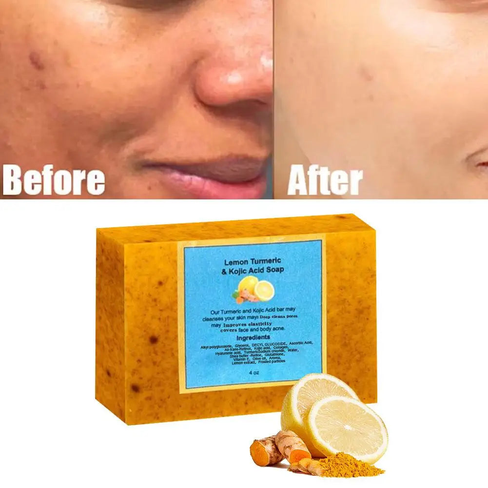 Savon biologique à l'acide kojique au citron et au curcuma pour les taches foncées, savon au curcuma pour le lavage du visage, éclaircissant, correcteur de taches foncées, soins pour la peau
