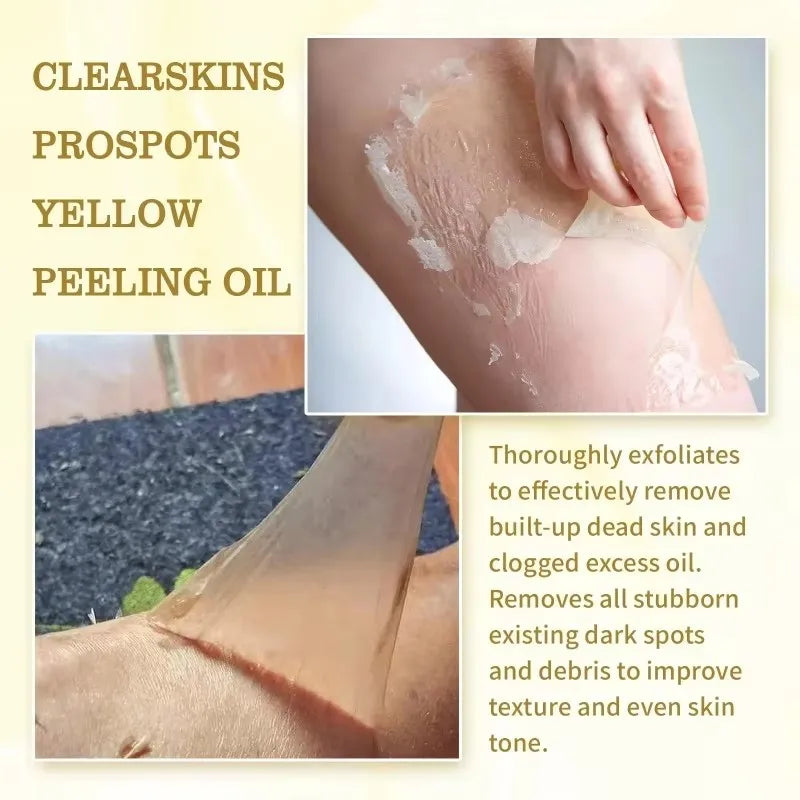 Huile de Peeling Jaune pour le Bain, Accessoire pour Blanchir la Peau Foncée, Éclaircir le Corps, les Coudes, les Genoux, la Main, Fréquence Exexponsive, Nourrir la Peau