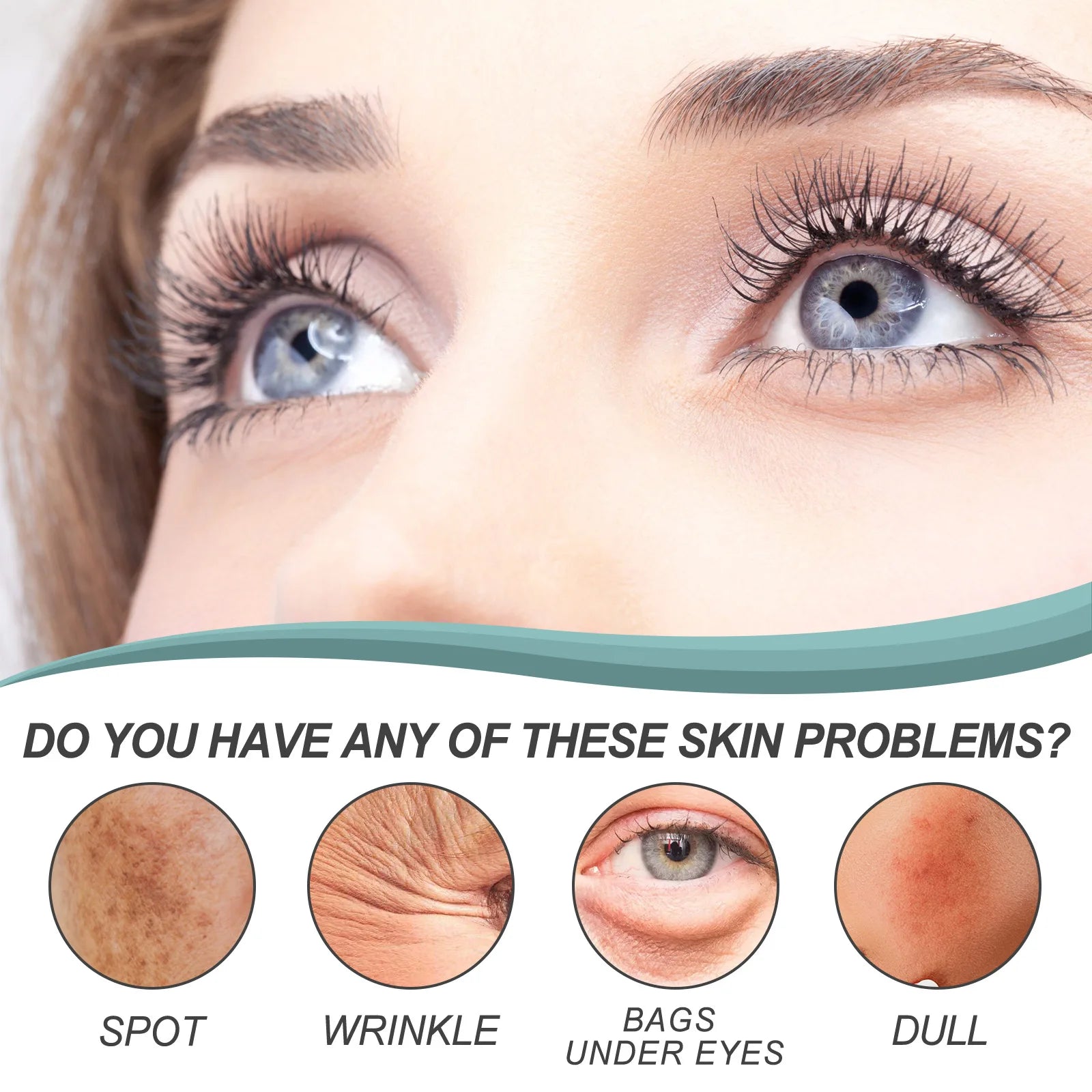 EELHOE – crème anti-taches foncées pour le visage, élimination de la pigmentation, mélasma, élimine l'hydratation en profondeur, éclaircissante pour la peau, crème Anti-taches de rousseur, 30g