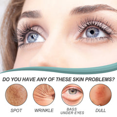 EELHOE – crème anti-taches foncées pour le visage, élimination de la pigmentation, mélasma, élimine l'hydratation en profondeur, éclaircissante pour la peau, crème Anti-taches de rousseur, 30g