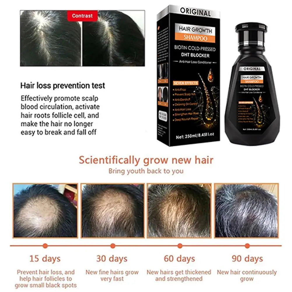 Shampoing au gingembre 250ml pour le nettoyage des cheveux, la stabilisation et les soins capillaires, répare la sécheresse des boucles et des dommages électrostatiques
